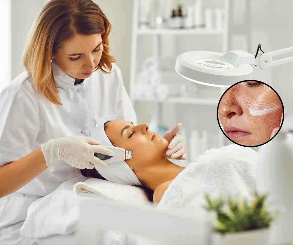 Modern laser pigmentation treatment improving uneven skin tone at NEO Skin Hyderabad under expert dermatological supervision